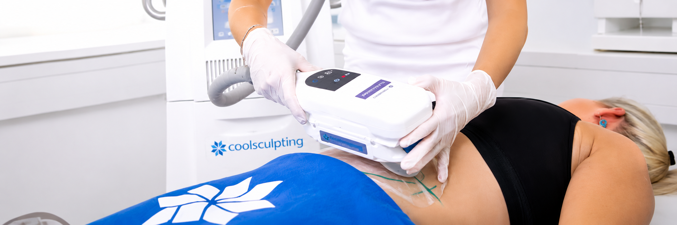 A practitioner performing a CoolSculpting body contouring treatment on a client using a certified pre-owned device available for rental from MedRent.